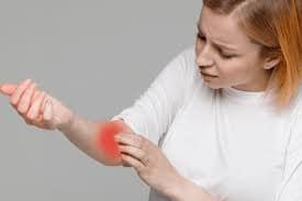 Melhores remédios caseiros para alergias